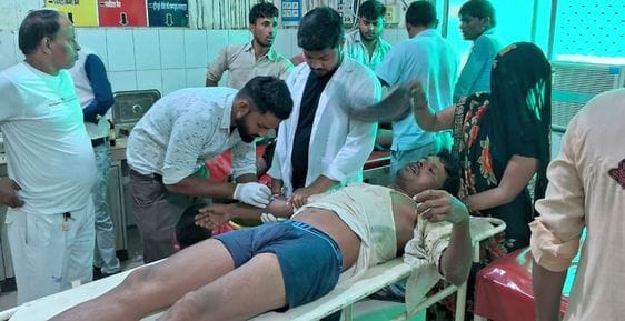 Three people got burnt due to electric current in boring machine, one in critical condition