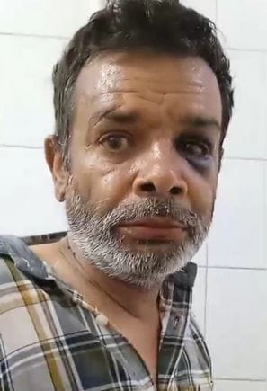 Postmortem report revealed... JE died due to serious injury