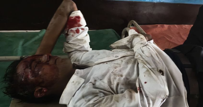 Doctors arrived 20 minutes late to treat the injured, family members are angry