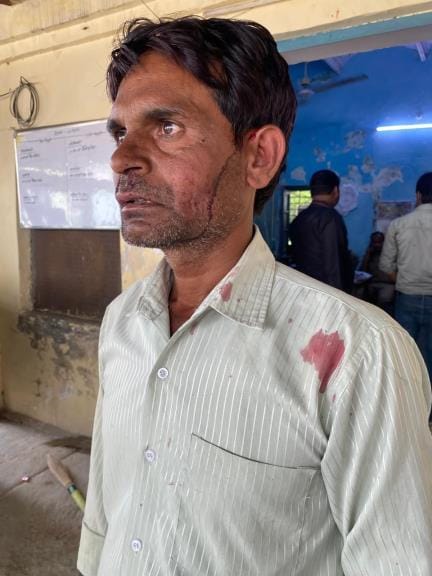 Railway employee working at the station was beaten up