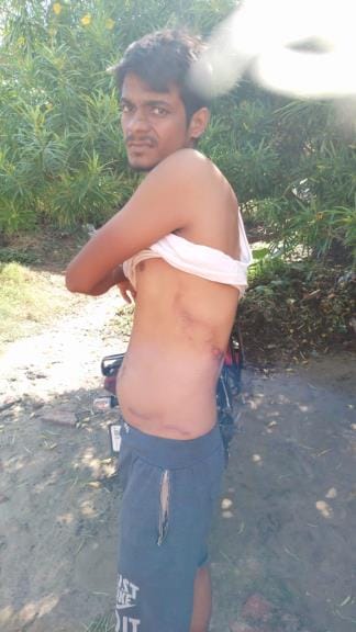 Mother and son burnt due to lightning in Baraipur village
