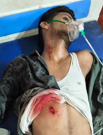 A young man who was smoking a cigarette was beaten and shot with a gun, he is in critical condition