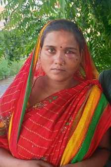 Brother and sister-in-law beaten up in water drainage dispute