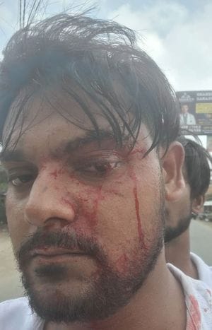 Lathi blows were used on loud drums in Muharram procession, two injured