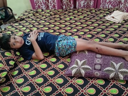 Anti rabies vaccine finished after four days, patients are returning