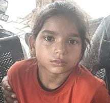 Monkey entered the house and injured the girl