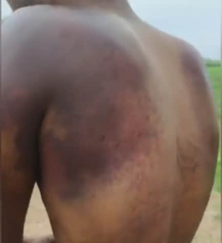 घायल आदिवासी