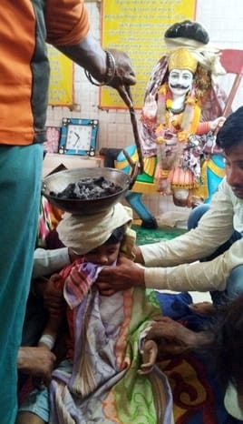 A frying pan full of embers was placed on the head, the innocent child did not breathe again