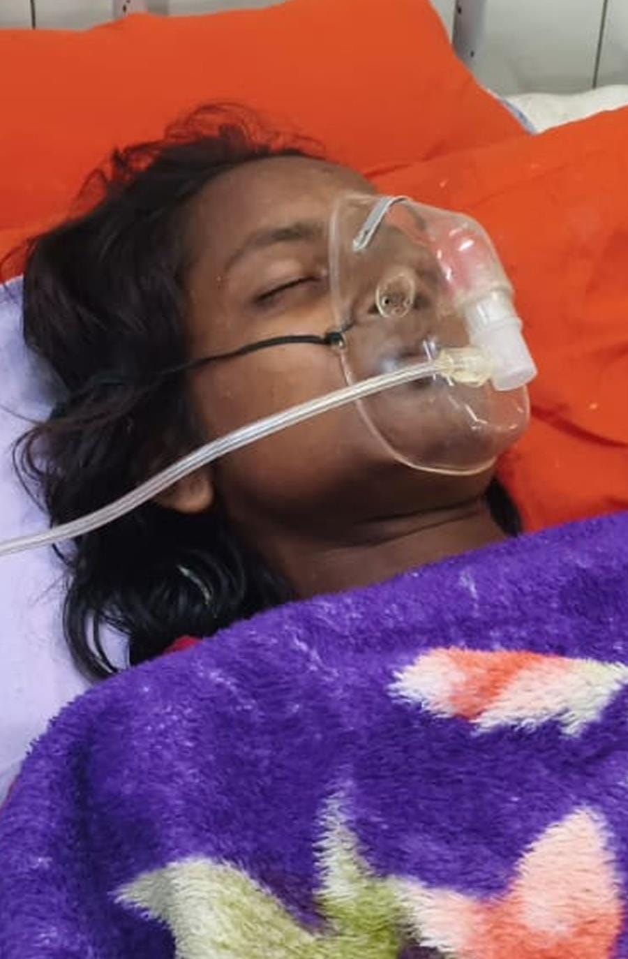 Two women, a young woman and a teenager got burnt due to lightning