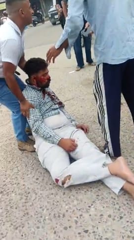 Car driver hits bike, young man seriously injured, referred to PGI
