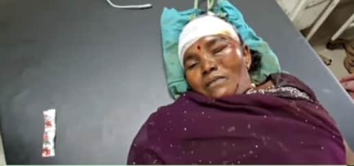 अस्पताल में इलाजरत घायल महिला।