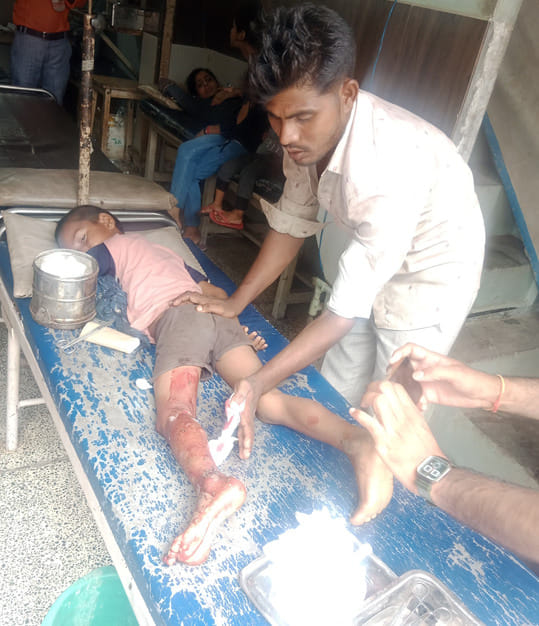 Child injured in monkey attack
