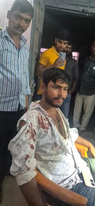 The miscreants beat up the youth and opened fire, pellets hit his hand