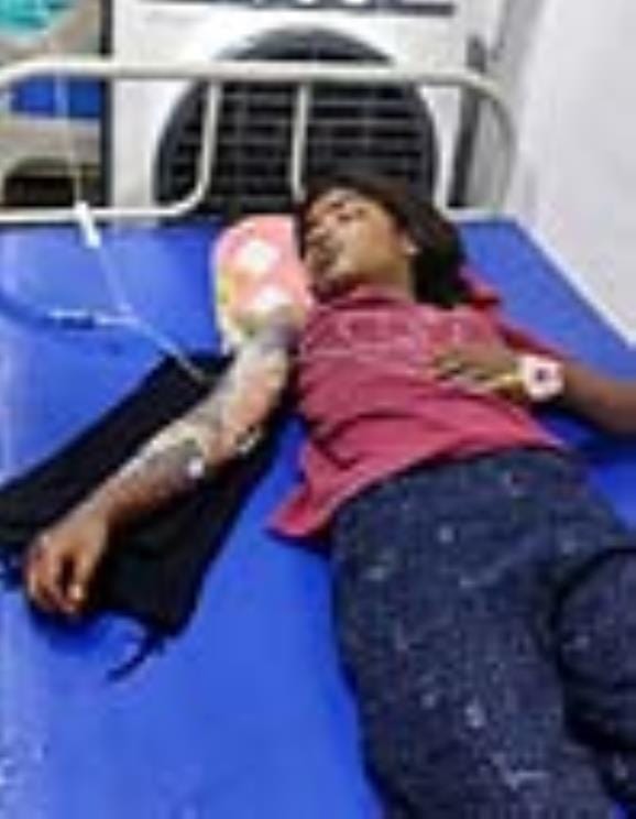 A girl got burnt after coming in contact with a high tension line hanging in the field