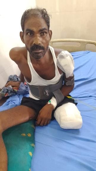 CMO summoned a report in the case of a laborer's leg being cut off thrice