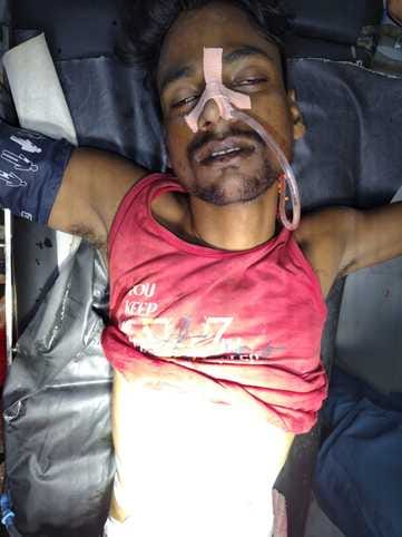 Bihar : सुधा डेयरी के कर्मी को अपराधियों ने मारी गोली, दौड़ कर खुद पहुंचा अस्पताल; अब सीसीटीवी खंगाल रही पुलिस