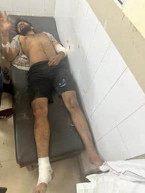 Sri Ganganagar: Shooters Sent to Kill Trader Jump Off Roof During Police Raid, Linked to Lawrence Bishnoi Gang