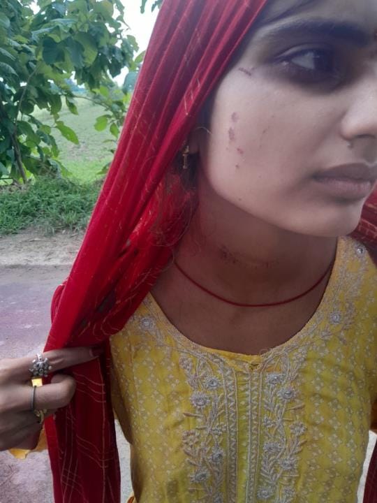 The in-laws attacked the parents and brother who came to take the daughter