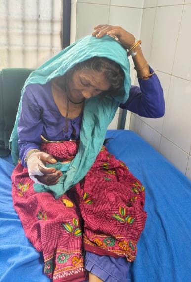 Elderly woman injured in monkey attack, people in panic