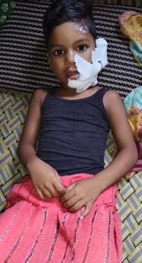 Dog bites two people, angry villagers beat them to death