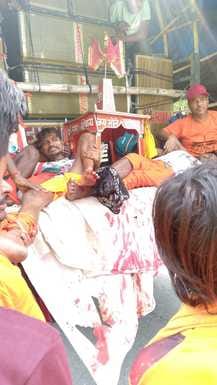 Two Kanwariyas returning after Jalabhishek were injured in an accident