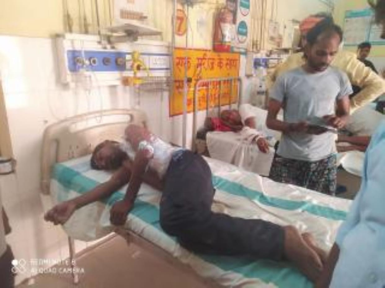 Two linemen were burnt while connecting wires to the transformer