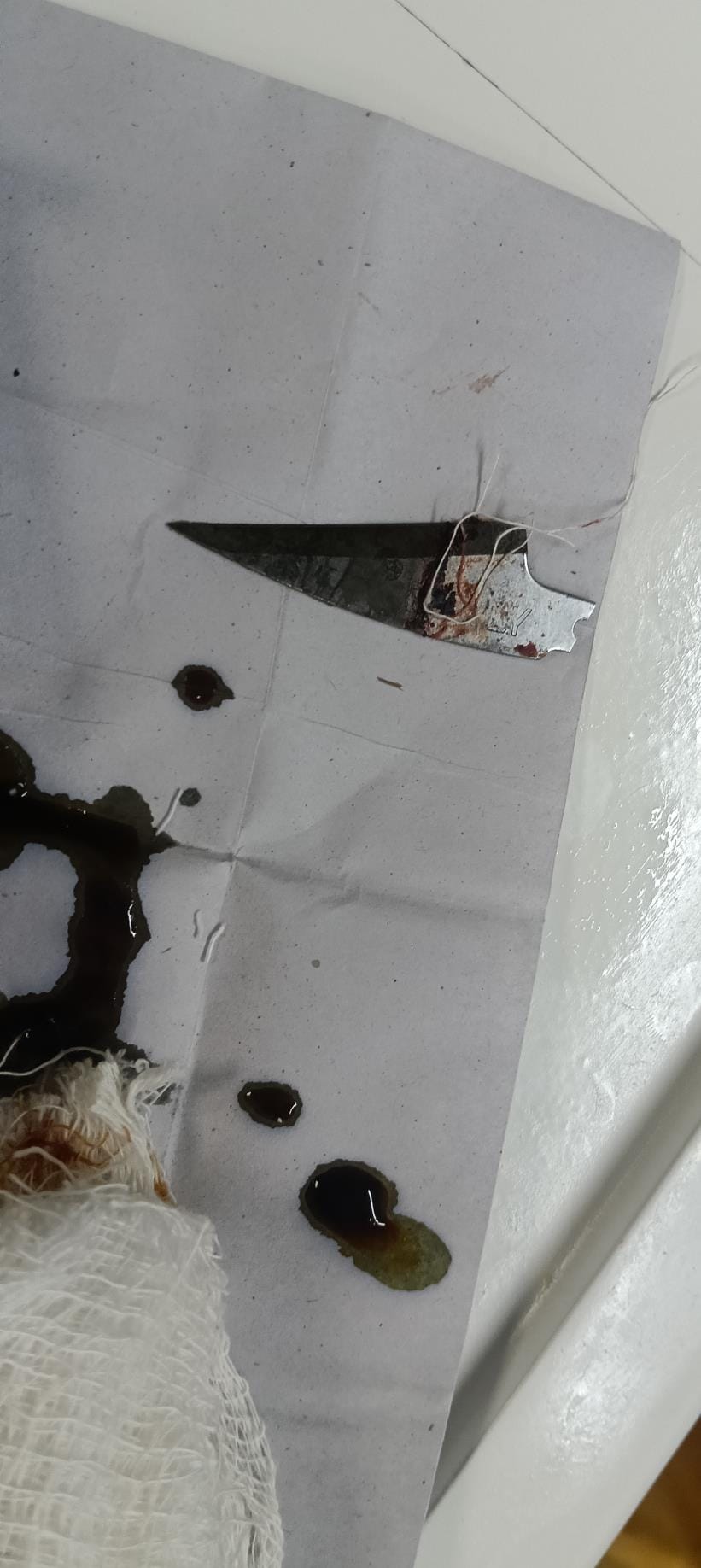 Two students clashed in a government school, a ninth class student was stabbed