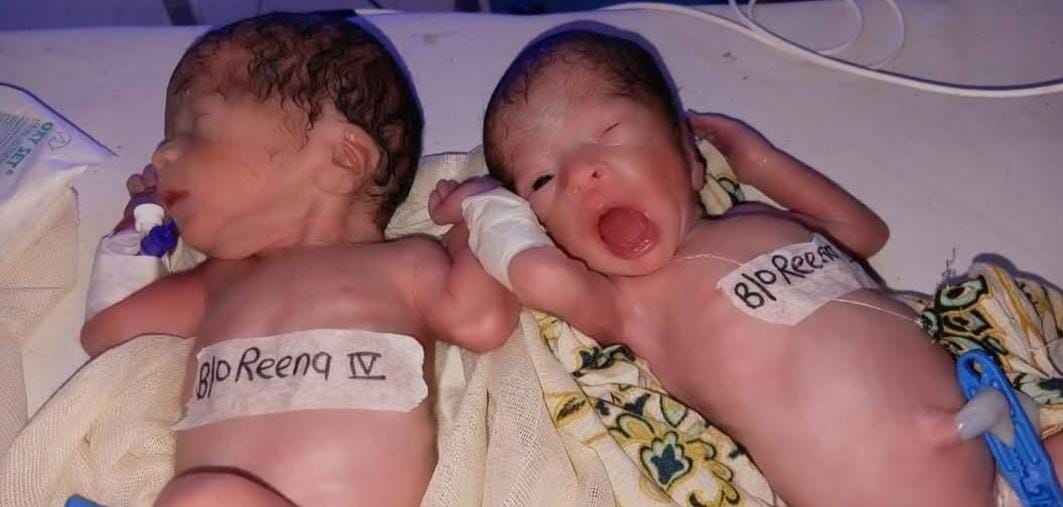 The woman gave birth to four children, all are healthy