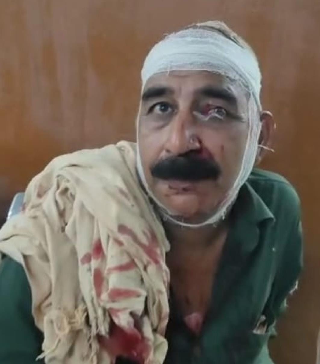 A drunk soldier broke the head of a head constable