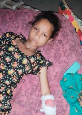 Monkey bites a teenager and injures her