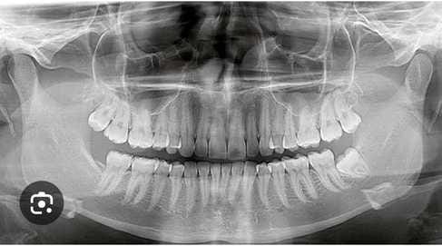 360 degree X-ray of jaw will be done in medical, OPG machine will be inaugurated today