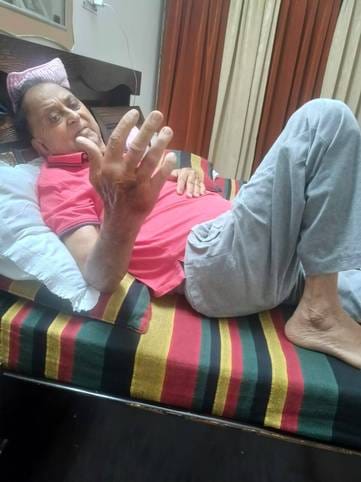 Monkeys bit a professor, even after two years the city residents are not free from them