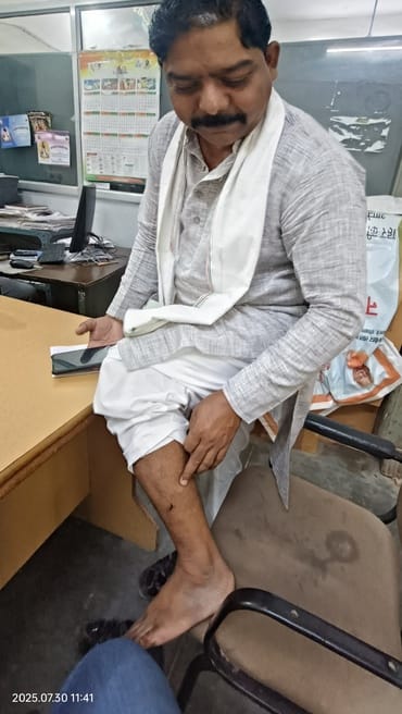When the head of Safai Karamchari Union was bitten by a dog, he remembered castration
