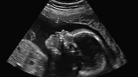 Shamli: Fetal gender determination exposed in hospital, case filed against doctor Khurshid Anwar and broker