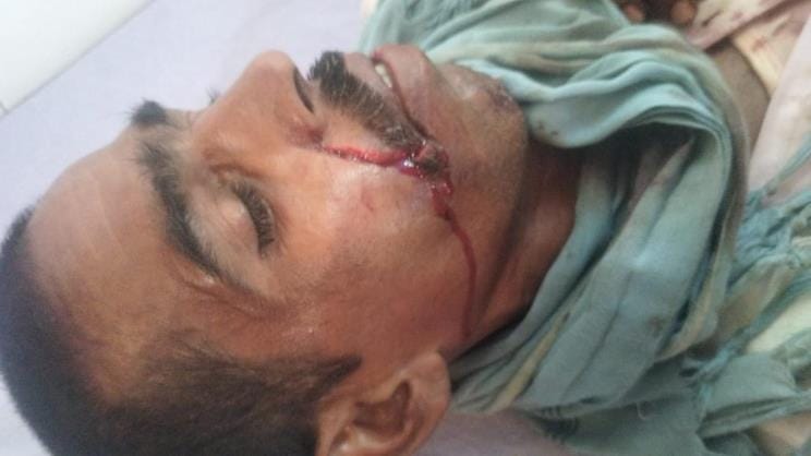 Farmer seriously injured in leopard attack
