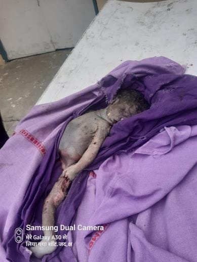 The baby was thrown in the bushes of the civil hospital and was mauled by dogs