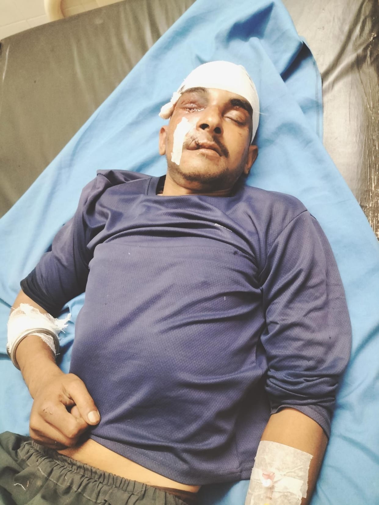 A young man was injured after falling into a ditch in Pachnai village