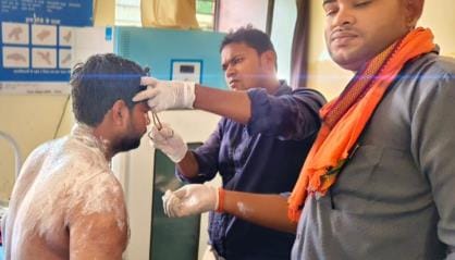 Acid thrown on the in-laws who came to resolve the dispute between husband and wife