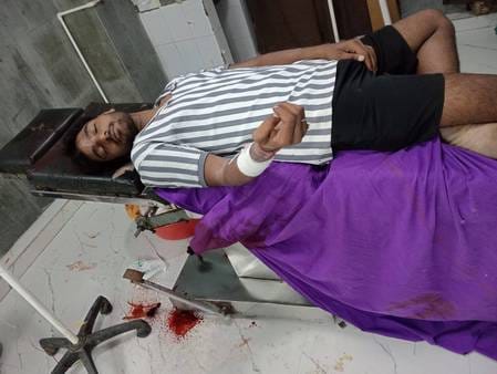 Rewari team catching stray animals attacked, two employees injured