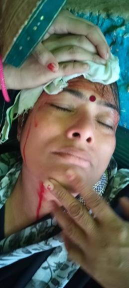 Three women injured in land dispute attacked with knife and iron rod