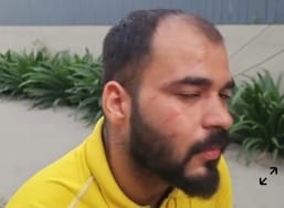 Two more injured by Gattu Door, one got 15 stitches on his neck