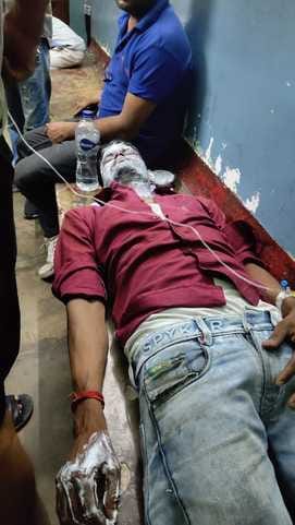 Contract worker gets burnt while working on power line