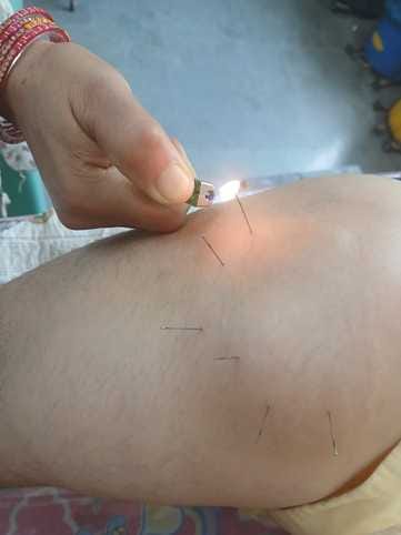 Panchkarma method of treatment started in Ayurvedic Hospital Lamblu