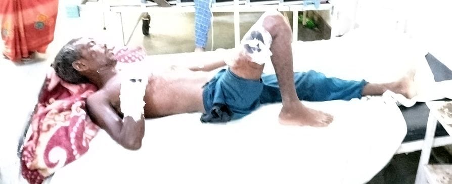 Bomb exploded in the fisherman's hand, fingers got cut off