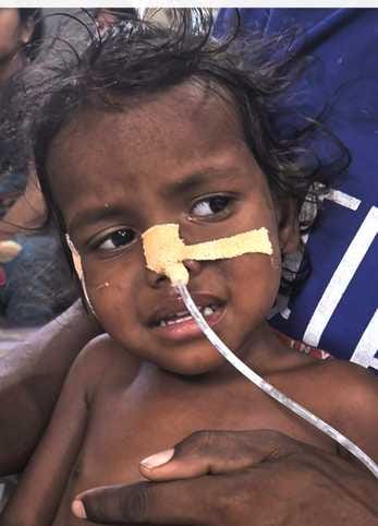 The snake bit the innocent child thrice, he came out of the jaws of death after treatment