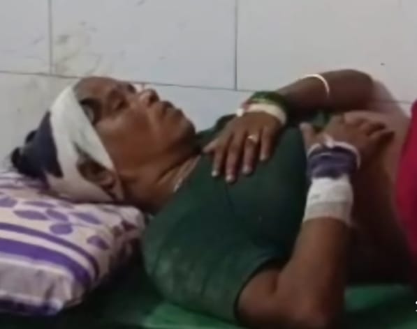 A dilapidated wall collapsed due to rain, a woman was injured
