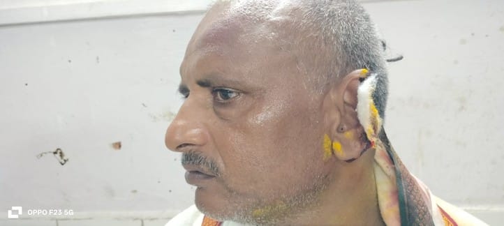 Before taking out the Tiranga Yatra, Pradhan's husband was attacked, his ear was chewed off