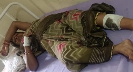 Woman injured in dog attack, husband files report