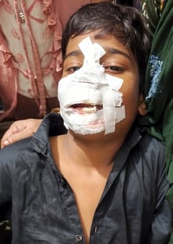 A bull entered the Chehalum procession and knocked down a teenager, causing a stampede