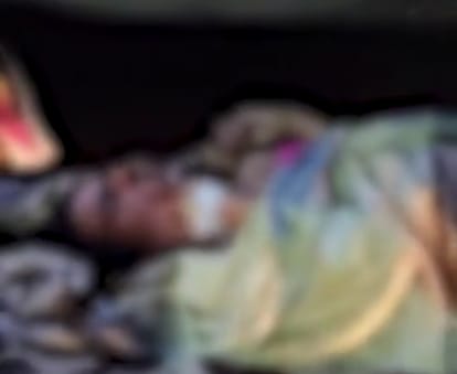 Crime News Narsinghpur Student sets fire to teacher by pouring petrol on teacher condition critical